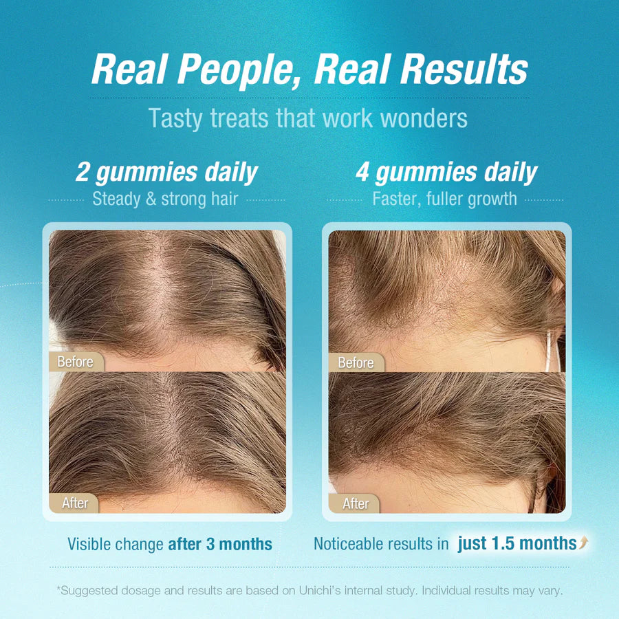 Unichi HAIR BOOST Gummy 60s